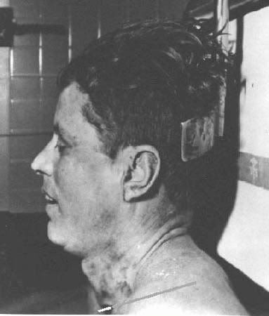 JFK_Autopsy_Photo_2.jpg