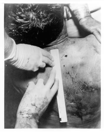 JFK_Autopsy_Photo_3.jpg